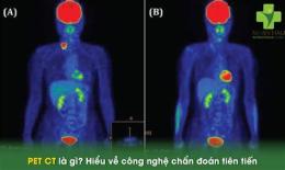 ảnh chụp màn hình dự đoán xổ số ct