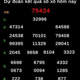 dự đoán kết quả xổ số mê
